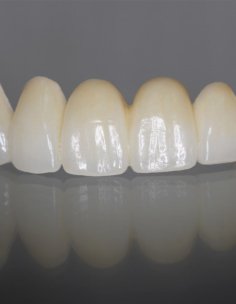 Treatment - Abbey Mead Dental & Implant Clinic