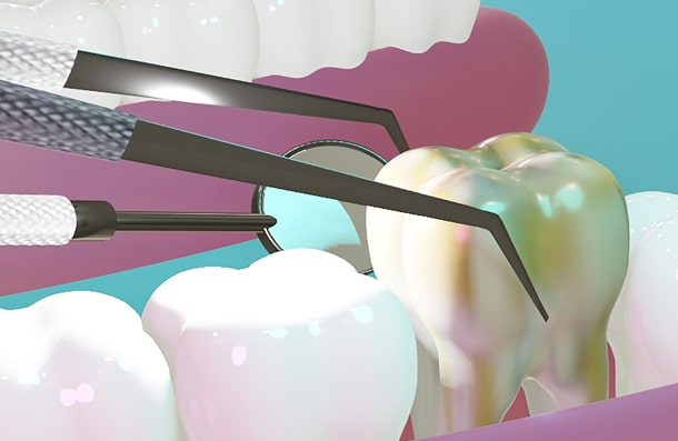 Abbey Mead Dental & Implant Clinic