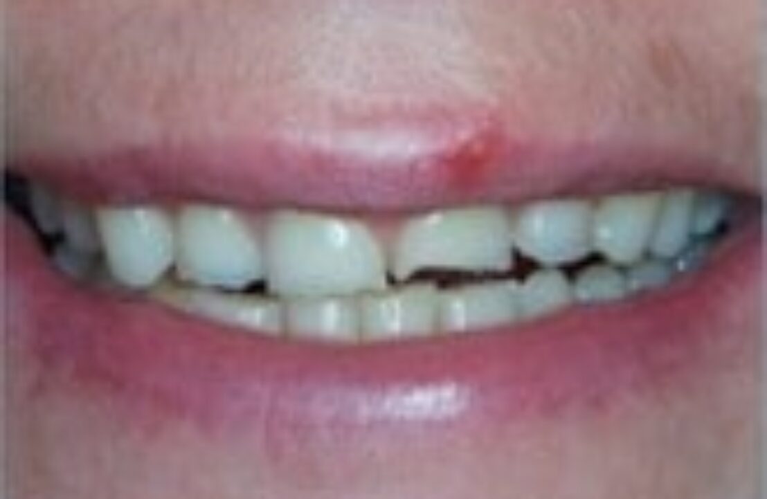 Before - Abbey Mead Dental & Implant Clinic