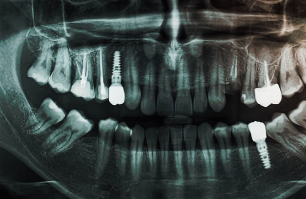 Abbey Mead Dental & Implant Clinic