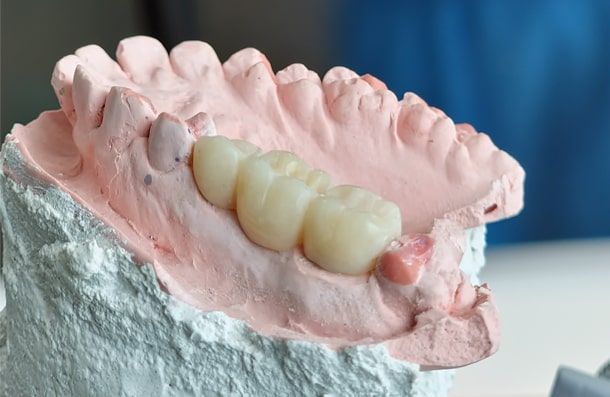 Abbey Mead Dental & Implant Clinic