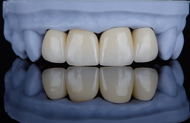 Abbey Mead Dental & Implant Clinic